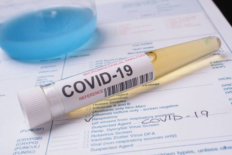 Rata de incidență la îmbolnăvirile de COVID nu va mai fi folosită